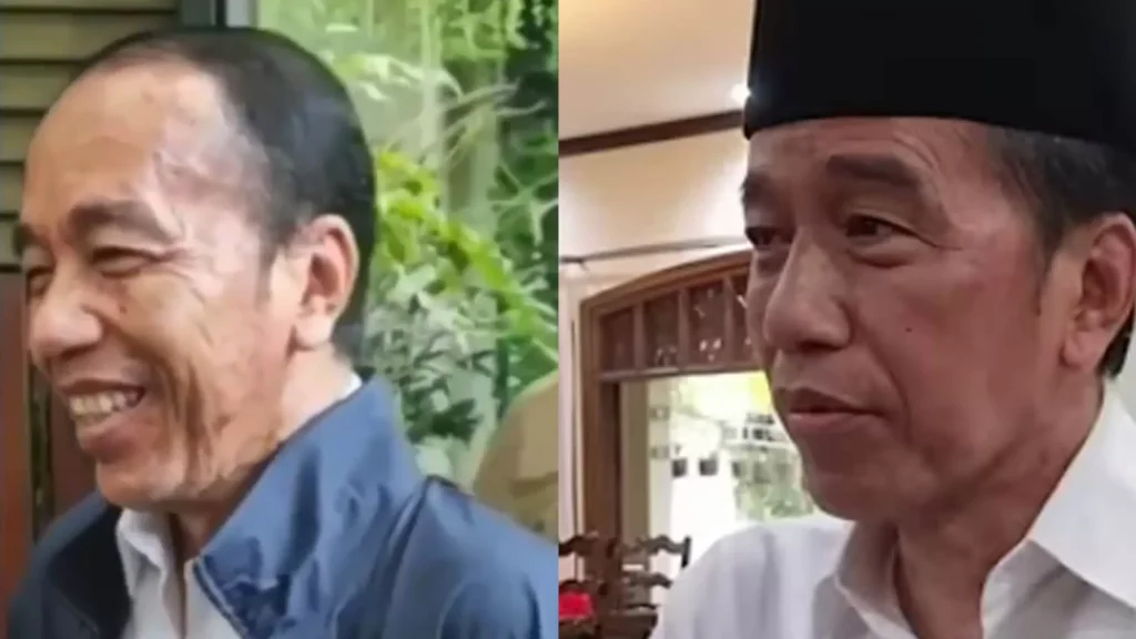 Jokowi diduga mengidap Sindrom Stevens Johnson, penyakit kulit langka dan serius yang butuh perawatan intensif.