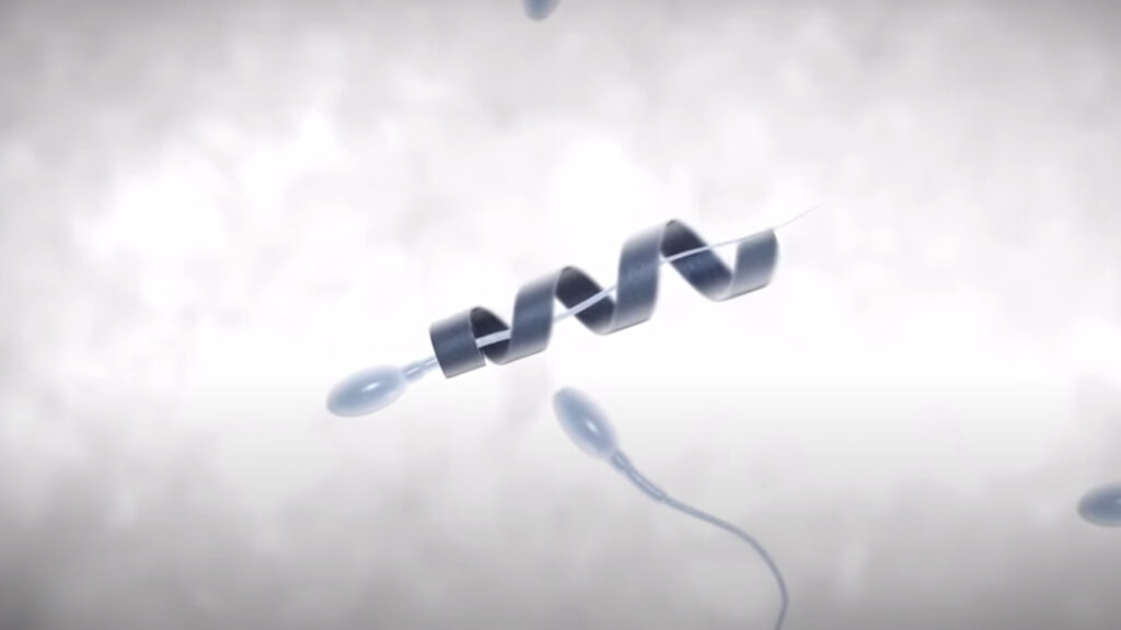 nanobot bantu sperma lemah berbentuk spiral logam melilit ekor sperma.