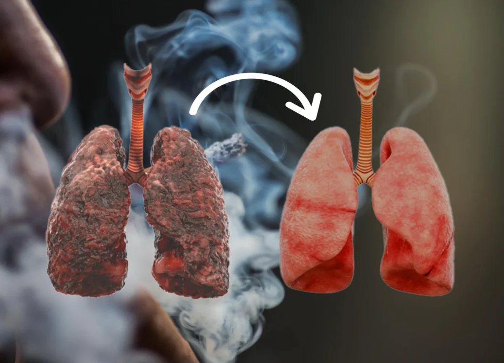 ramuan herbal bersihkan paru dan atasi batuk kronis.
